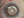 Figure 7. Final positioning of the IOL with a sutured CTS.
Pupillary cerclage is then performed.