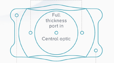 Mastering the Preoperative Exam