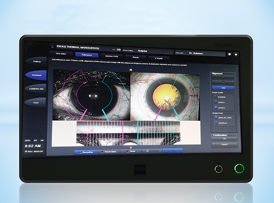 CALLISTO eye Versus Intraoperative Aberrometry