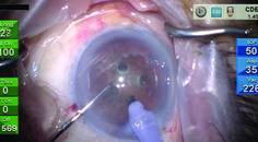Rotary Chop