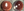 Figure 3. Two years after implantation, an eye with a FEMTIS IOL shows no signs of anterior capsular
fibrosis (left), compared to an eye that received a standard in-the-bag monofocal IOL (right).