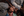 Figure 1. A portrait of a child with bilateral cataract, who is waiting for surgery in Basankusu, Democratic Republic of the Congo.
Courtesy of Andras D. Hajdu and the International Agency for the Prevention of Blindness