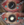 Figure 2. Before fluid-air exchange, there is a clear view through the IOL (A). After fluid-air exchange, there is condensation on the IOL’s posterior surface, making further posterior surgery challenging (B).