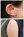 Figure. True (top) and sham (bottom) acupuncture therapy as used by Dr. Dhaliwal and colleagues in their study.
