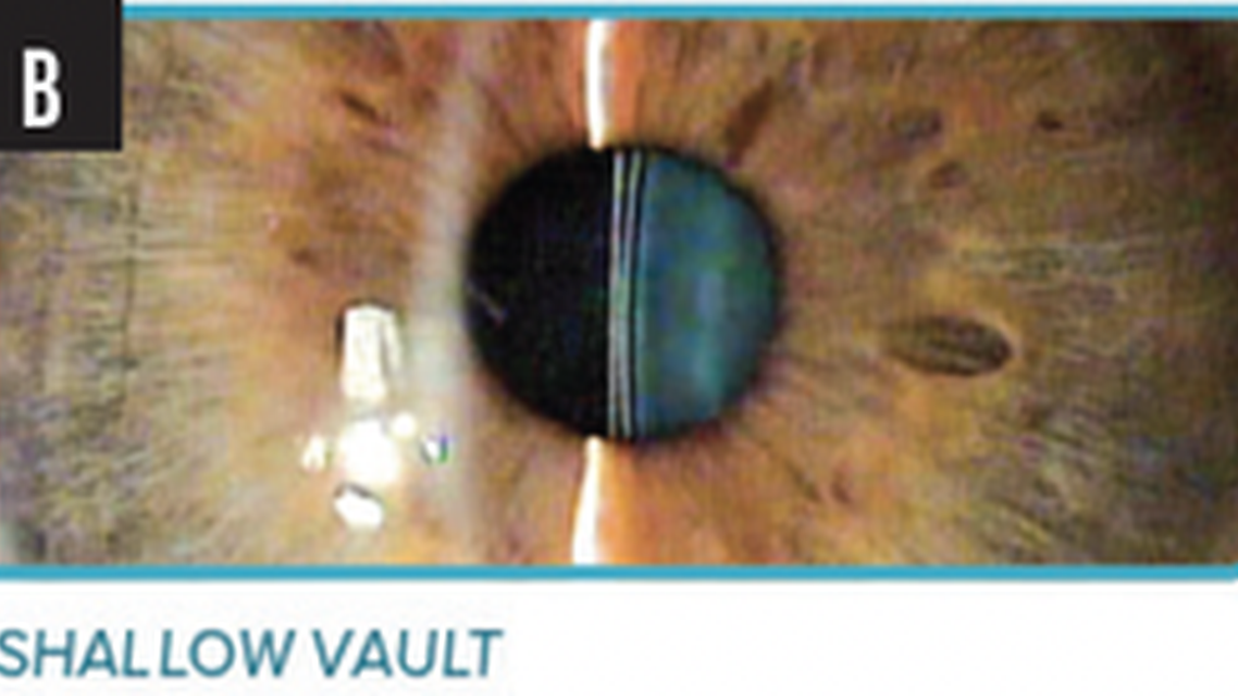 What You Can Expect With Patient Outcomes