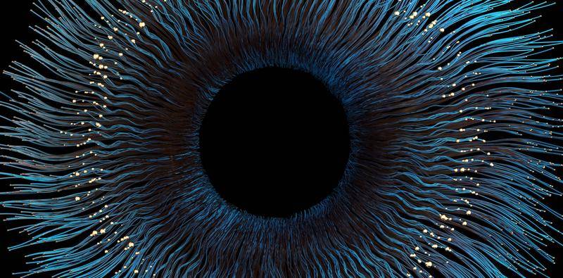 Iris Prostheses in K tastrophes