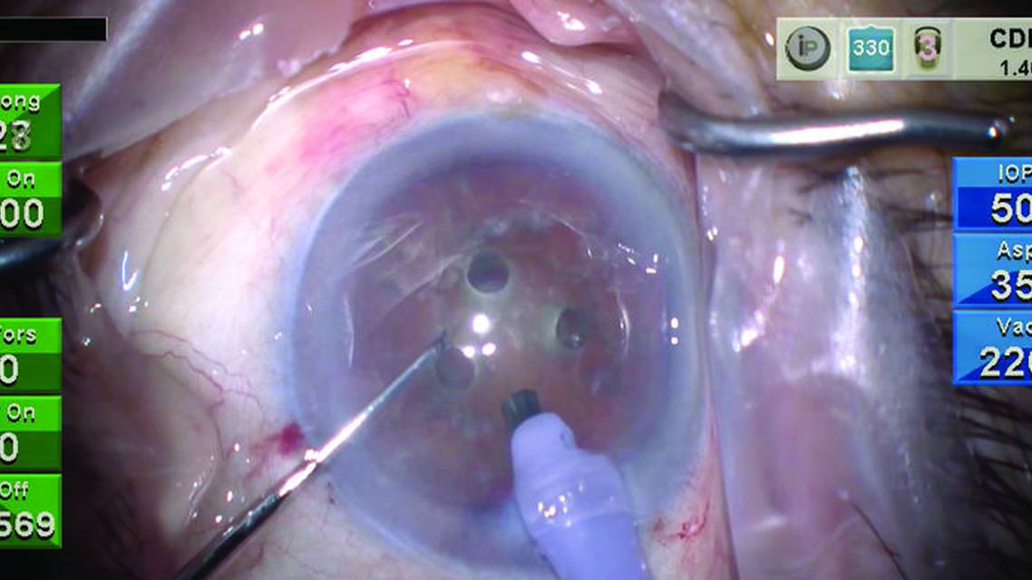 Rotary Chop