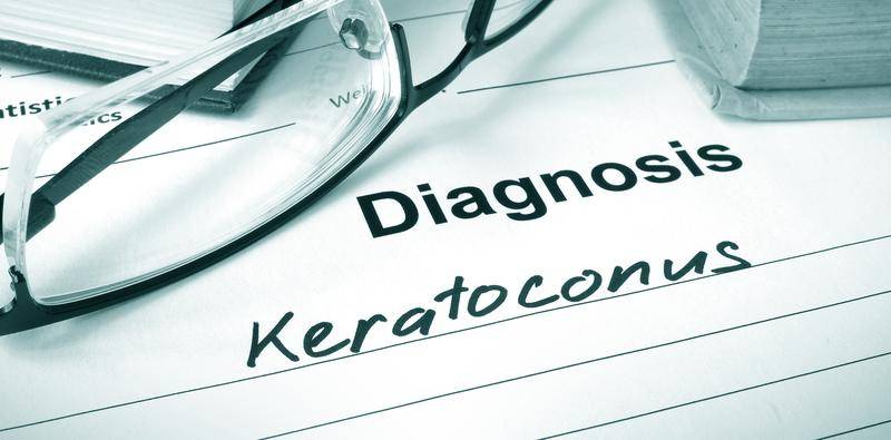 Keratoconic Progression After Epithelium on CXL