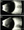 Figure 2. B-scan ultrasound images of the patient’s left eye.