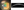Figure 3. A slit-lamp photograph of the right eye 1 day after SMILE shows epithelial clusters in the central cornea (A). AS-OCT shows epithelial hyperreflectivity but a clear interface (B).