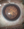 Figure 2. A laser capsulotomy was created in an eye that had previously undergone an Nd:YAG vitreolysis for floaters. A PC breach led to the sudden formation of a cataract. The laser created a well-centered, 5.2-mm capsulotomy should sulcus fixation of an IOL with optic capture be required.