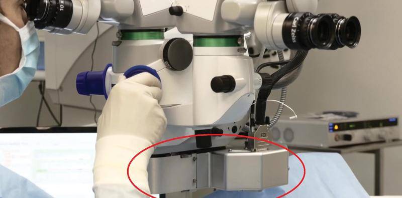 Assessing the CapsuLaser for Primary Posterior Capsulotomy