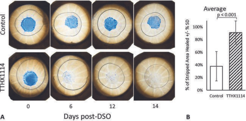 New Horizons in Corneal Endothelial Therapy